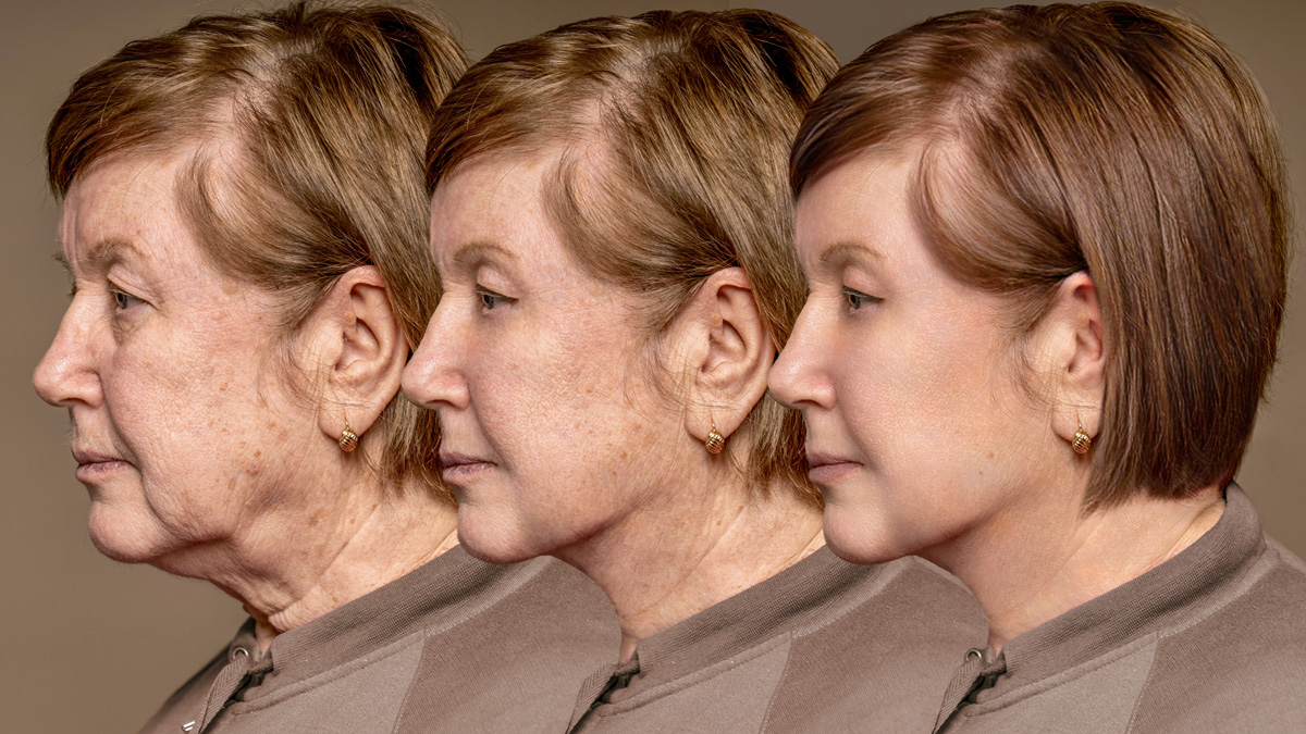 Alzheimers patient