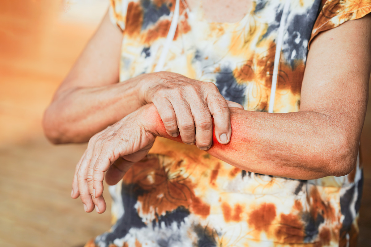Alzheimers patient