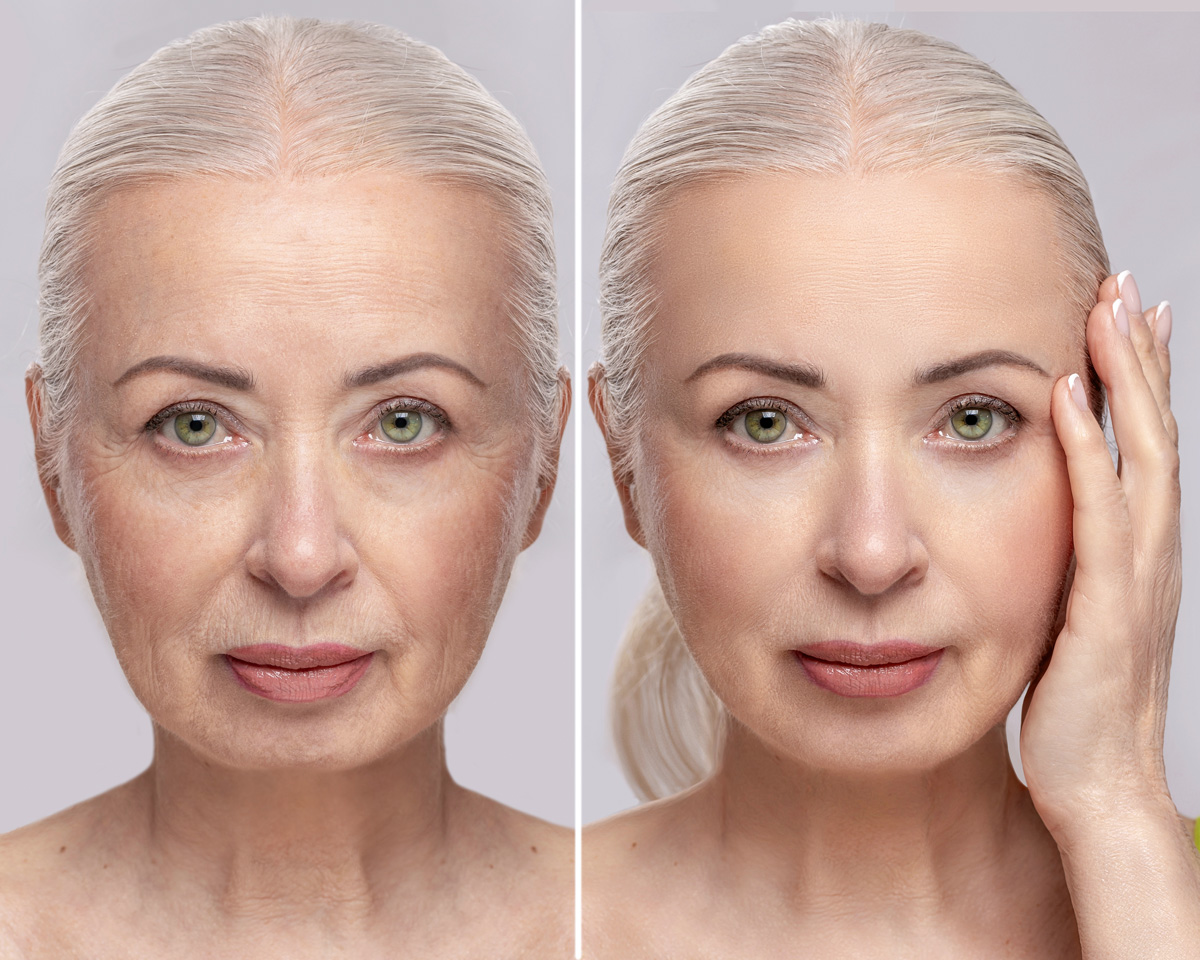 Alzheimers patient