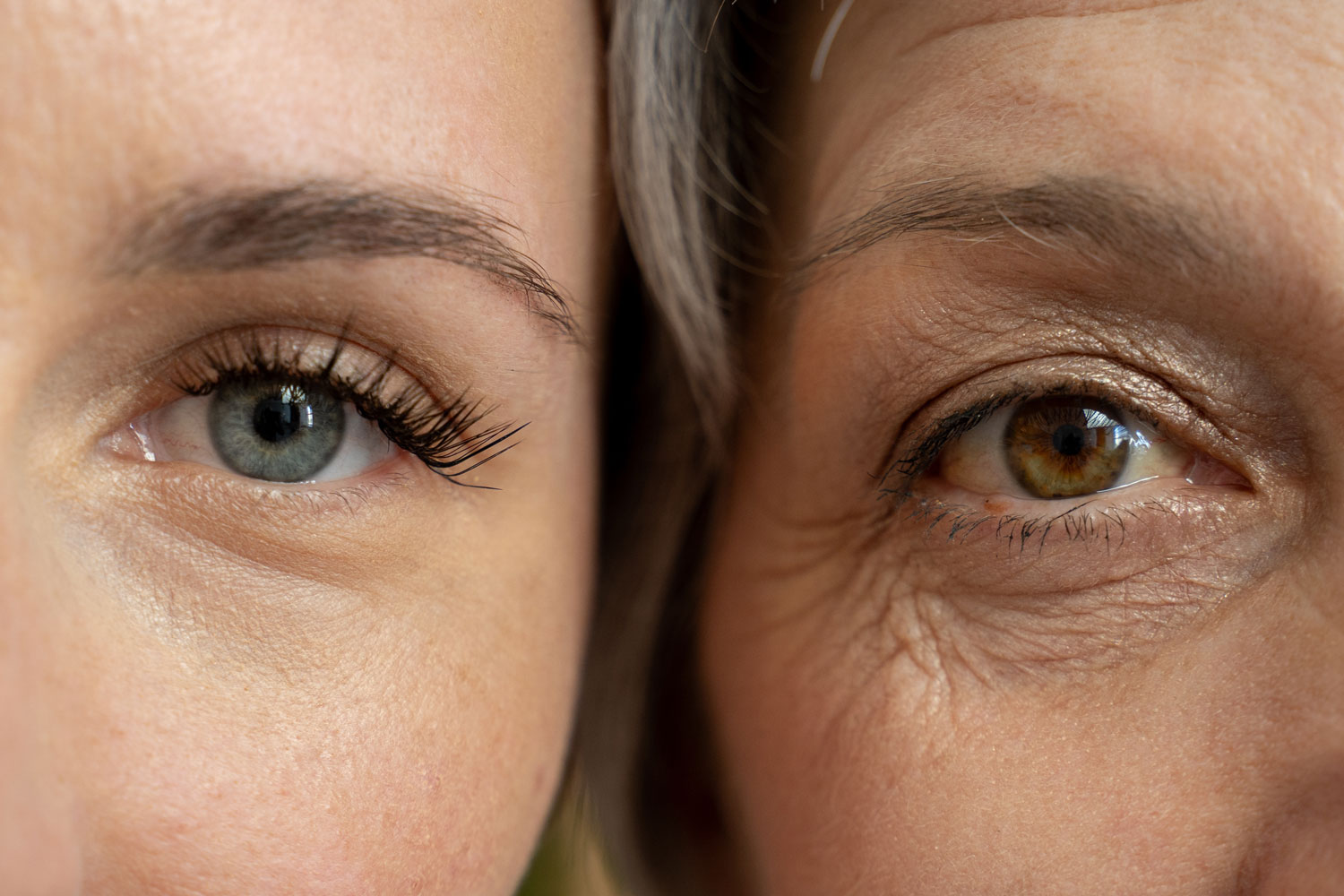 skin degeneration