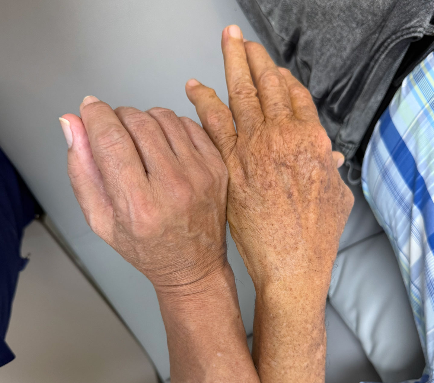Aging Skin