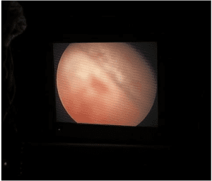 After treatment
